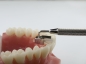Preview: Replacement tips for Tiger Dental MiniMold (palatal bite block)