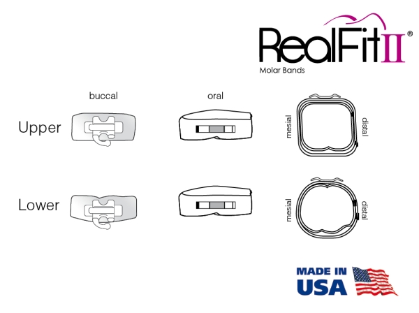 RealFit™ II snap - Bevezető készlet, felső állkapocs, 3 részes együttes + palatinális zár (17, 16, 26, 27), Roth .022"